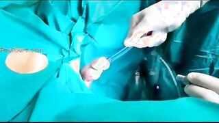 Removing Toothbrush in Urethra